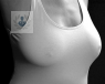 La reducción de pecho es una intervención que se lleva a cabo en mujeres con hipertrofia mamaria. Es una intervención que consiste en eliminar el tejido fibroglandular.