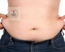 El tubo gástrico es un tipo de operación de reducción de estómago que se hace por laparoscopia y no deja apenas cicatriz