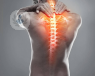 dolor cervical osteopatía - Top Doctor