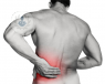 La lumbalgia se manifiesta con dolor irradiado en la zona baja de la espalda