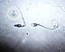 analisis espermatozoides