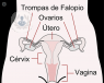 El cáncer ginecológico afecta a un gran número de mujeres. Se da en el aparato reproductor femenino y en las mamas de la mujer.