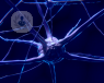 La neuromodulación permite modificar el funcionamiento de las regiones cerebrales que no funcionan correctamente.