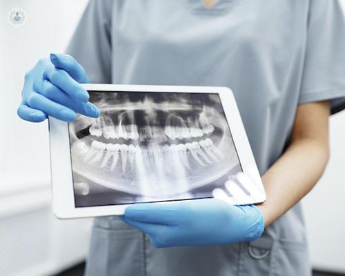especialista en Odontología mira radiografía