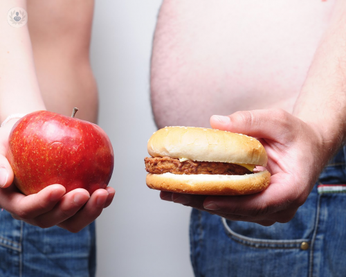 La obesidad puede aumentar el riesgo de desarrollar otro tipo de enfermedades más graves