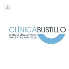 Clínica Dental Bustillo Cirugía Maxilofacial e Implantes Dentales
