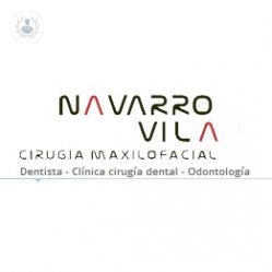 Clínica Dental Navarro Vila - Cirugía Oral y Maxilofacial