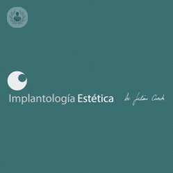 Clínica Dental Implantología Estética Dr. Julián Cuesta