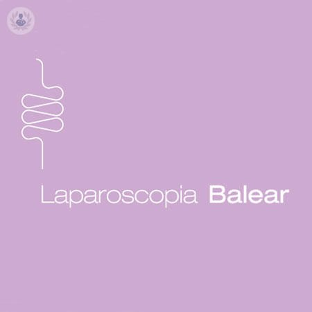 Laparoscopia Balear