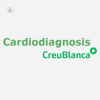 Cardiodiagnosis - Clínica Creu Blanca