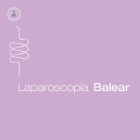 Laparoscopia Balear