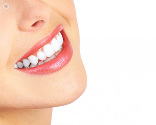 Chica mostrando los dientes sonriendo - dientes blancos - blanqueamiento by Top Doctors