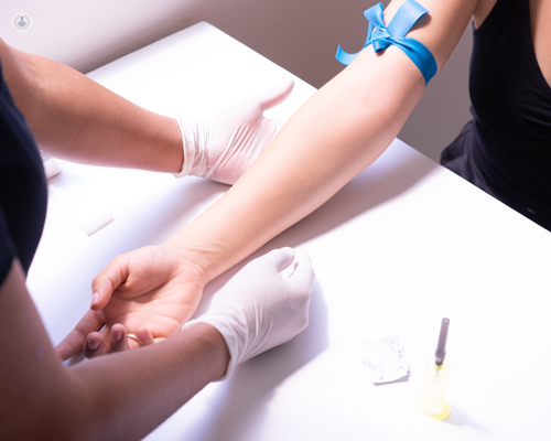 Primer plano del brazo de un paciente a punto de realizarse una analitica - litio | by Top Doctors