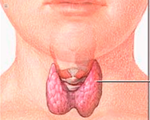 tiroiditis-inflamacion-tiroides