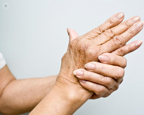 Manos de mujer, entrelazadas, con reuma o artritis - reuma y COVID-19 - by Top Doctors