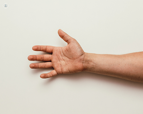 Preguntas Frecuentes, Artrosis de mano y dedo