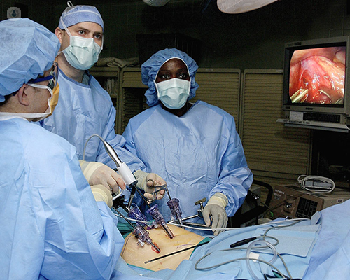 Ejemplo de cirugía laparoscópica