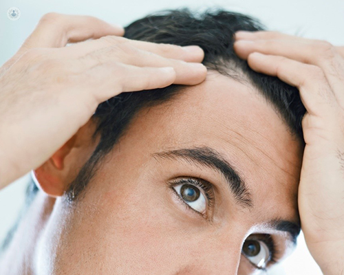 Causas y remedios para la alopecia Top Doctors
