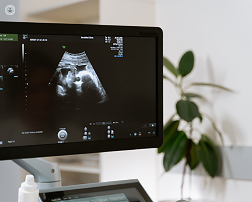 Primer plano de una pantalla con una ecografía de un embarazo - ADN fetal en sangre materna | by Top Doctors