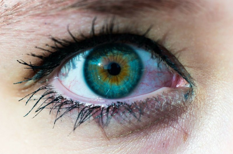 Las lentes intraoculares permiten que el ojo enfoque a varias distancias después de una operación de cataratas