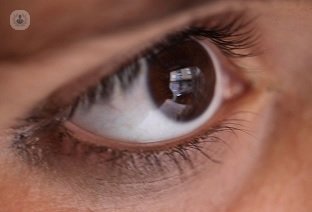 El nistagmus es un movimiento de vaivén de los ojos que puede ser de diversos tipos, tal y como explica el Dr. Juan García Oteyza.