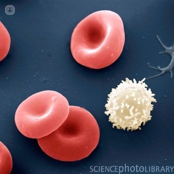 La falta de hierro es el paso previo al desarrollo de la anemia. Conoce en este artículo más acerca de esta patología sintomática.
