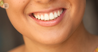 ¿Sabías que la Estética Dental permite resolver problemas bucales y de armonía estética de la sonrisa? La Dra. Galera te informa