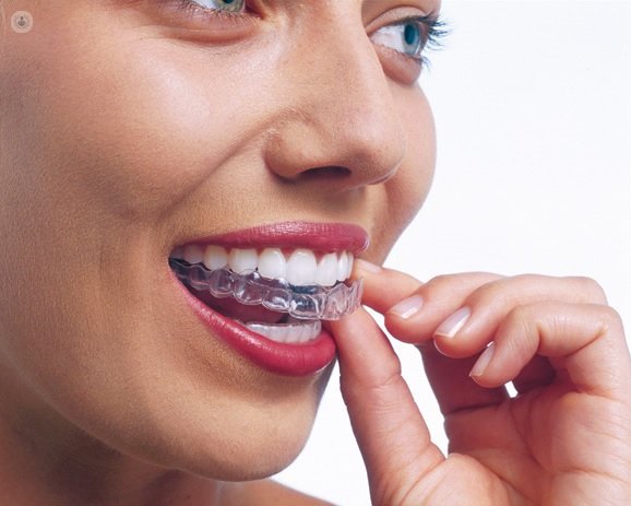 El bruxismo o rechinamiento de los dientes es un hábito en que se aprietan los dientes
