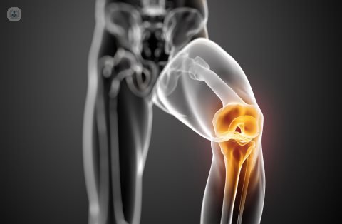 Un recambio de prótesis se hace cuando una prótesis implantada está dañada