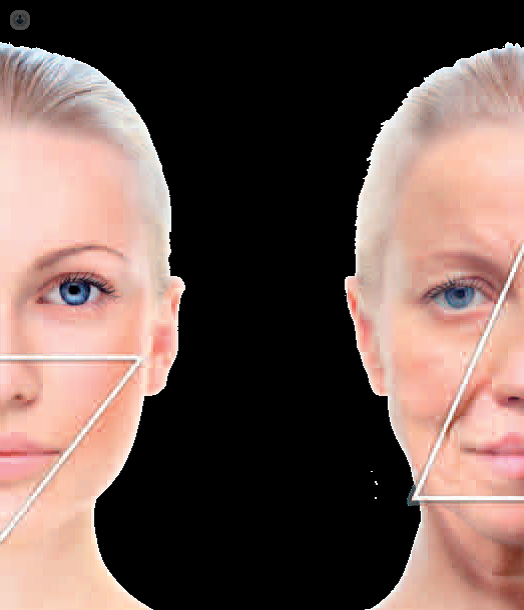 Con el paso del tiempo se producen cambios en el rostro, perdiendo elasticidad y firmeza de la piel.
