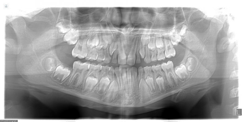 стоматологический ортопантомография