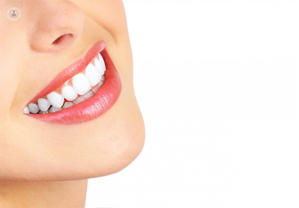 La estética dental comprende una serie de tratamientos para lucir una sonrisa perfecta.