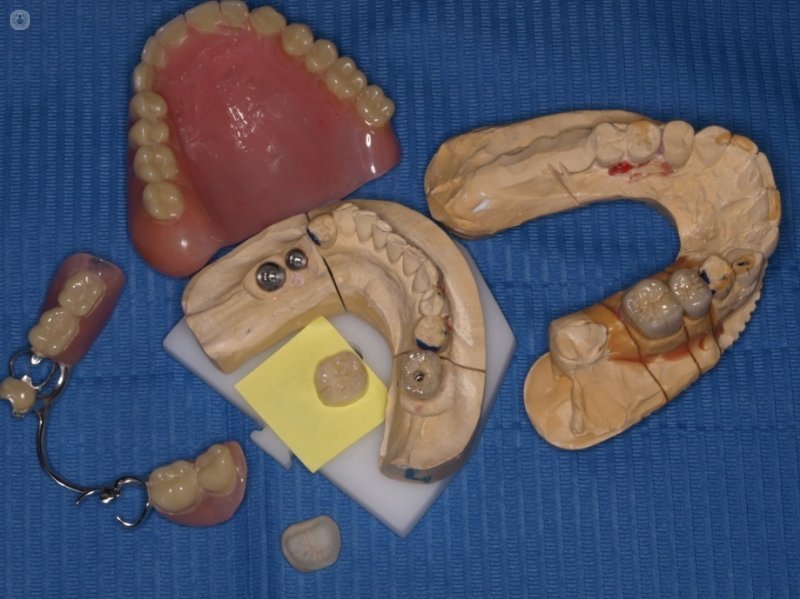 protesi dentarie