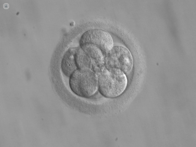 embrione umano