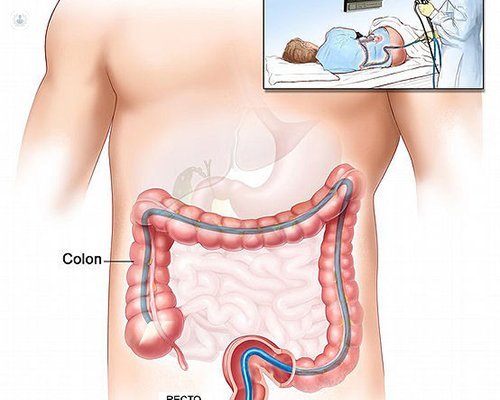 Endoscopia digestiva