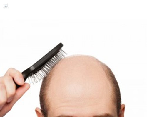 пересадка волос клиника Tufet