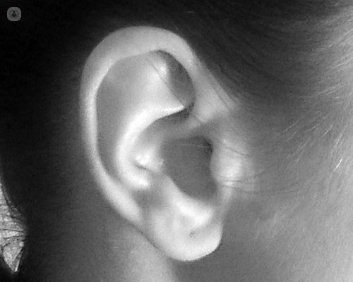 imagen oreja otosclerosis