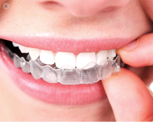 ortodoncia invisible: ventajas y resultados en Top Doctors