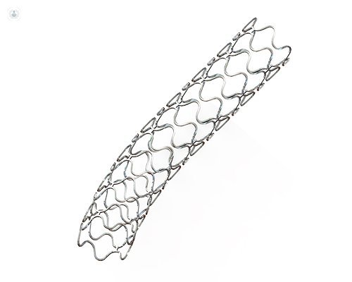 peripheral stent