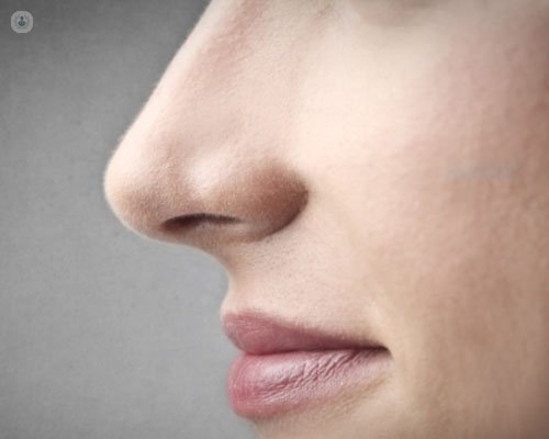 rinoplastia y estética nasal | Top Doctors