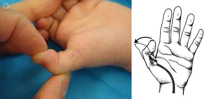 пружинный палец