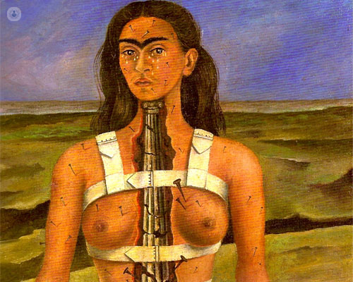 La columna rota - Frida Kahlo