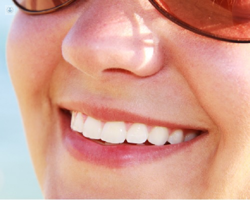 sonrisa bonita odontología