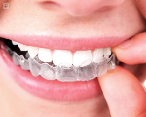 Ferula de descarga salud oral Blog pacientes