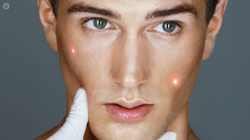 bioremodelación facial rejuvenecimiento resultado natural y duradero - Top Doctors