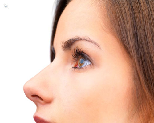 Las deformidades nasales pueden ser funcionales o estéticas - Top Doctors