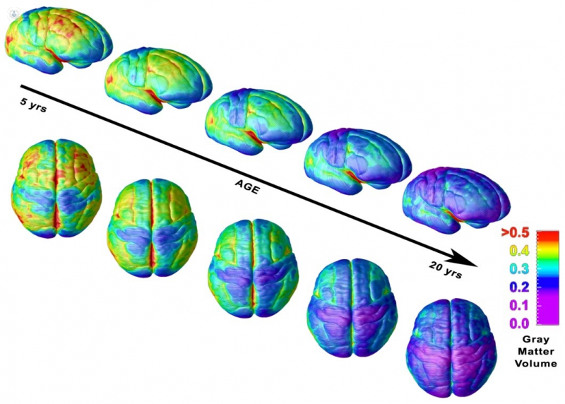 Madurez cerebral, que se adquiere con el paso de los años, marcada en azul-violeta - Top Doctors