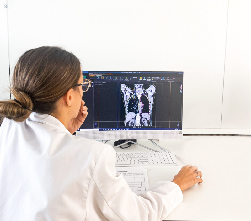 HC Marbella dispone de la radioterapia más avanzada para el tratamiento del cáncer de pulmón