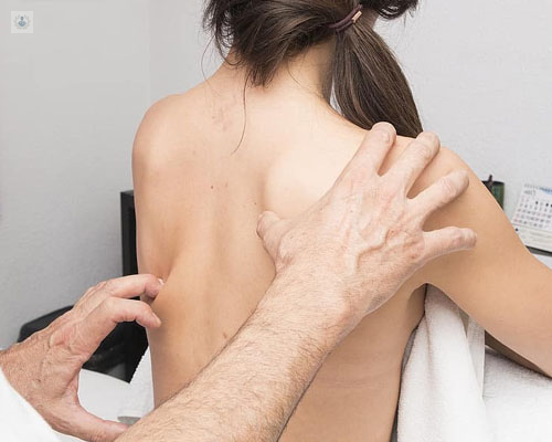 Primer plano de las manos de un doctor examinando la espalda de una paciente - escoliosis joven - by Top Doctors