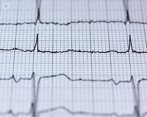 El electrocardiograma forma parte de la revisión cardiológica